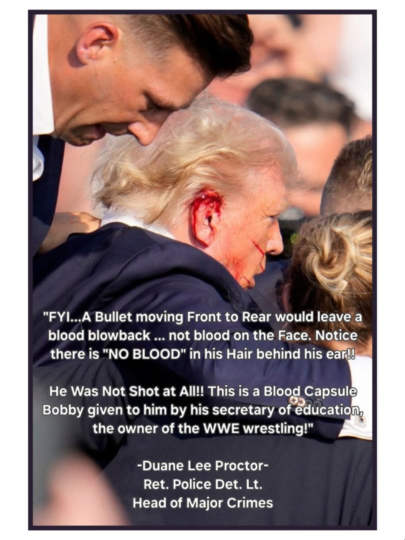 Hilltop__Leader's tweet image. 💯 agree. #TrumpPRStunt that killed 2 people. Shame on the #SecretService for taking part in the public #Scam Largest clue... The professional victim stopped talking about it. 🤬