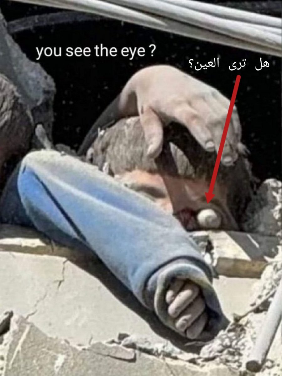 تامر أبو العمرين-غزة 🇵🇸 (@lml1859628) on Twitter photo هل ترى العين؟ 👁️
إذا غمضت عينيك دون أن تنشر..  
فاعلم أنك أَغْمضتَها على دماء أطفال غزة 
فكن العين التي لا تنام..  🕯️
👁️ #كن_عين_غزة هل ترى العين؟ 👁️
إذا غمضت عينيك دون أن تنشر..  
فاعلم أنك أَغْمضتَها على دماء أطفال غزة 
فكن العين التي لا تنام..  🕯️
👁️ #كن_عين_غزة