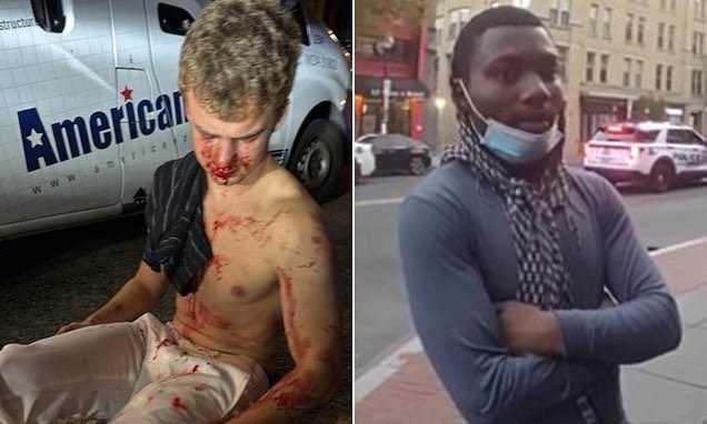 🚨BREAKING: Thugs that beat DOGE staffer “Big Balls” were just released from juvenile custody with one teen released to a youth shelter and the other to home confinement, the D.C. attorney general's office just announced.

DC AG Brian Schwalb is a radical activist.