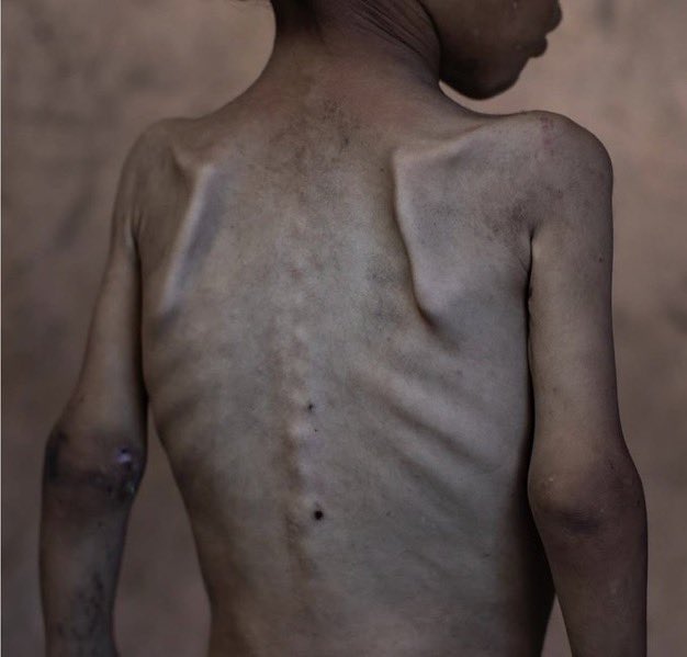 TRUST1552171's tweet photo. In conclusion: Those who besiege #Gaza and starve its children cann't claim morality or religion. Those who kill civilians cann't be "chosen" except by the war machine, not by Allah. #Palestine
. 
Cracker Barrel
GCSE
Levy
#iceraids
Rovers
#RCSABIF
#DestinationX https://t.co/9uJcx0lGVK