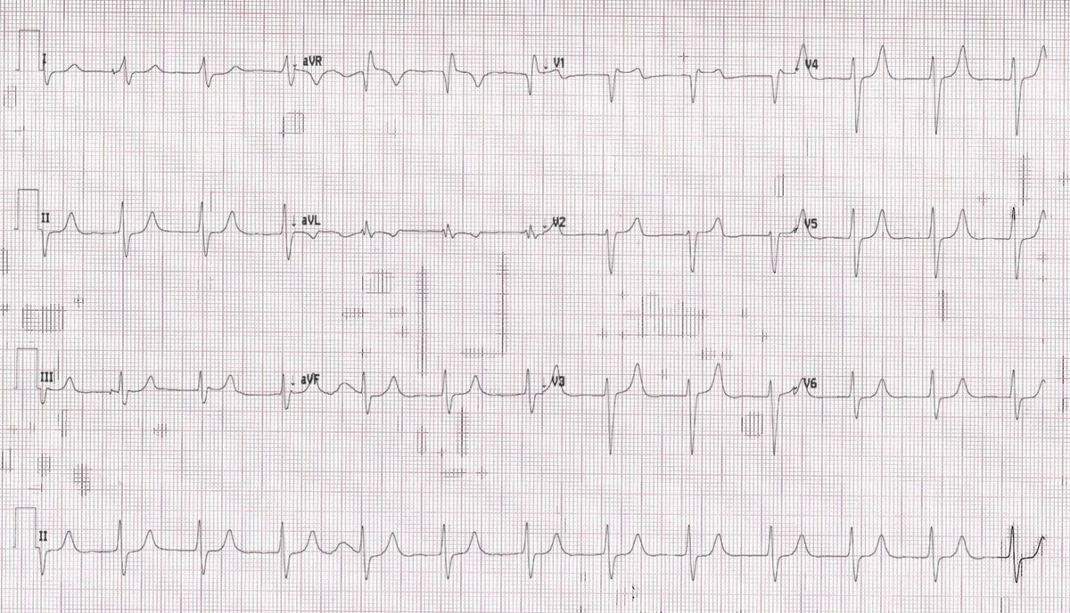 EM Case of the week: weak &amp; brash
erpocketbooks.com/more-mysteries…