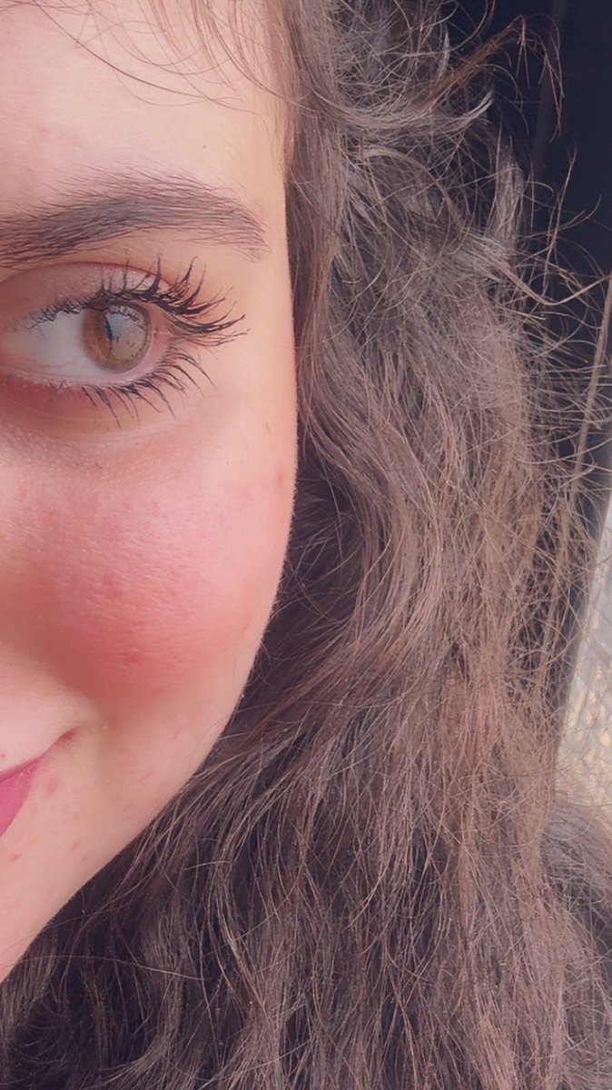 𝘙𝘖𝘡𝘈𝘓𝘐𝘕𝘋𝘈 tweet media