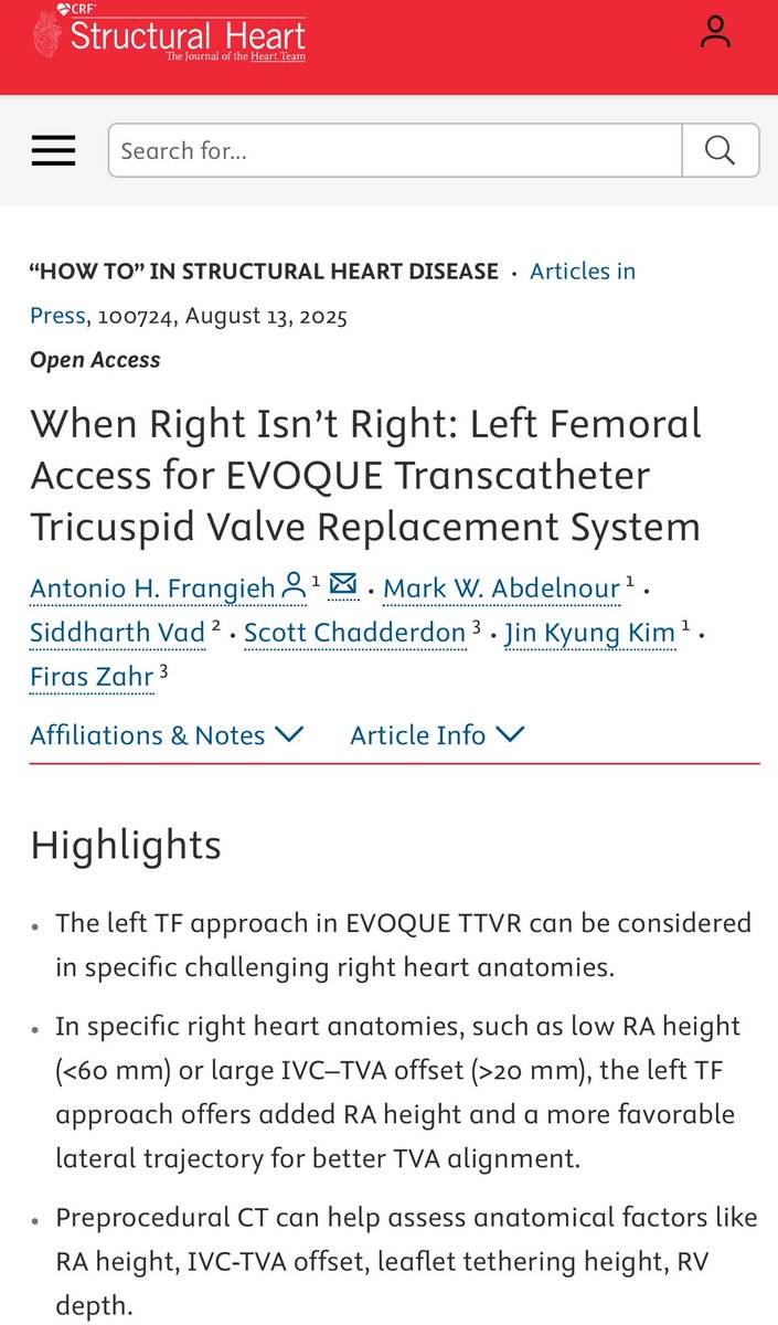 DrAFrangieh's tweet photo. 👇our recent publication in the Structural Heart Journal
“When Right Isn’t Right: Left Femoral Access for #EVOQUE Transcatheter Tricuspid Valve Replacement System”
Consider #Left_Access in selected anatomies including low RA height or large IVC-TVA offset
https://t.co/skGKI6Mqol https://t.co/EDIcUhzDFK