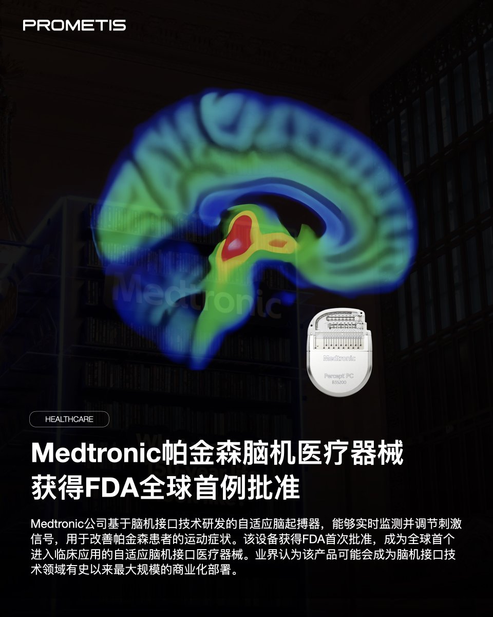 PROMETISccn's tweet image. Medtronic公司基于脑机接口技术研发的自适应脑起搏器，能够实时监测并调节刺激信号，用于改善帕金森患者的运动症状。该设备获得FDA首次批准，成为全球首个进入临床应用的自适应脑机接口医疗器械。

#PROMETIS #Consultancy #healthcare #Medtronic #脑机接口 #帕金森 #FDA #医疗AI #parkinson