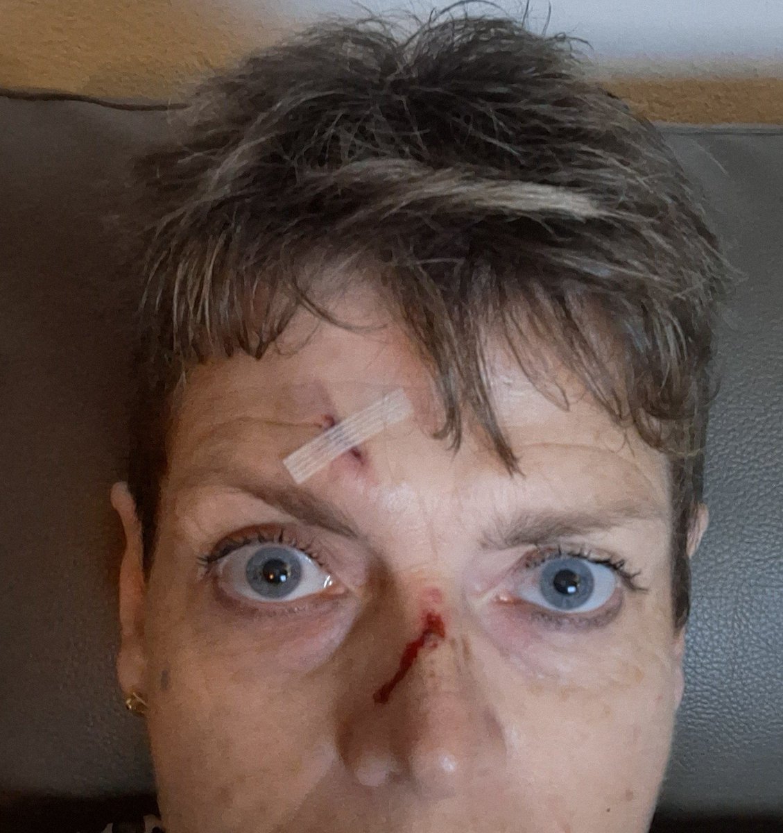 En zo krijg je een balk op je hoofd🙈 braderie, een rukwind..gewoon 3 kramen om😳 Helpen met 1 overeind zetten...omdat iedereen gewoon doorliep😳😭
Waar zijn de echte mannen??
Maar mijn helpen werd niet beloond. Nu een bult en koppijn..maar we gaan vrolijk door🤭