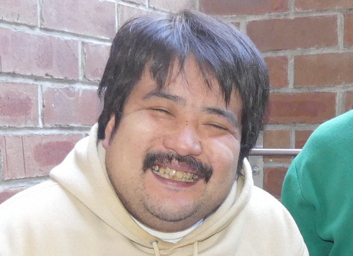 livedoornews's tweet photo. 【改善】空気階段・鈴木もぐら、「徒歩の鳩に抜かされた」ため人工股関節手術を決意
https://t.co/lClWEHuz4b

鈴木もぐらは長年、股関節の不調に悩んでおり、今春に人工股関節を入れる手術をしたという。「おんぼろの自転車が電動自転車になったぐらい」と歩行速度が速くなったことを喜んだ。 https://t.co/WsfDyNsmVb