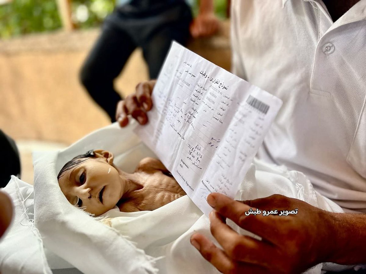 Palestinahoy01's tweet photo. Fallecimiento de la niña palestina Ghadir Barika (5 meses) debido a la desnutrición y la falta del tratamiento necesario para su estado de salud después de su nacimiento, como consecuencia del bloqueo y el genocidio en Gaza. https://t.co/pHCwsFnIuQ