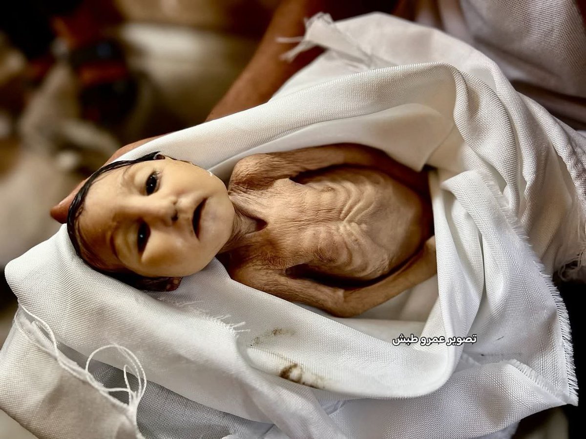 Fallecimiento de la niña palestina Ghadir Barika (5 meses) debido a la desnutrición y la falta del tratamiento necesario para su estado de salud después de su nacimiento, como consecuencia del bloqueo y el genocidio en Gaza.