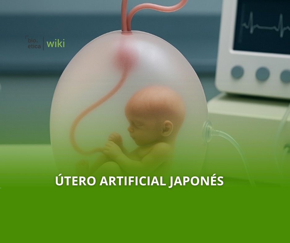 bioeticared_'s tweet image. instagram.com/p/DNXSJQ_t_v4/…
.
.
#Uteroartificial
#Gestacionartificial
#Avancescientificos