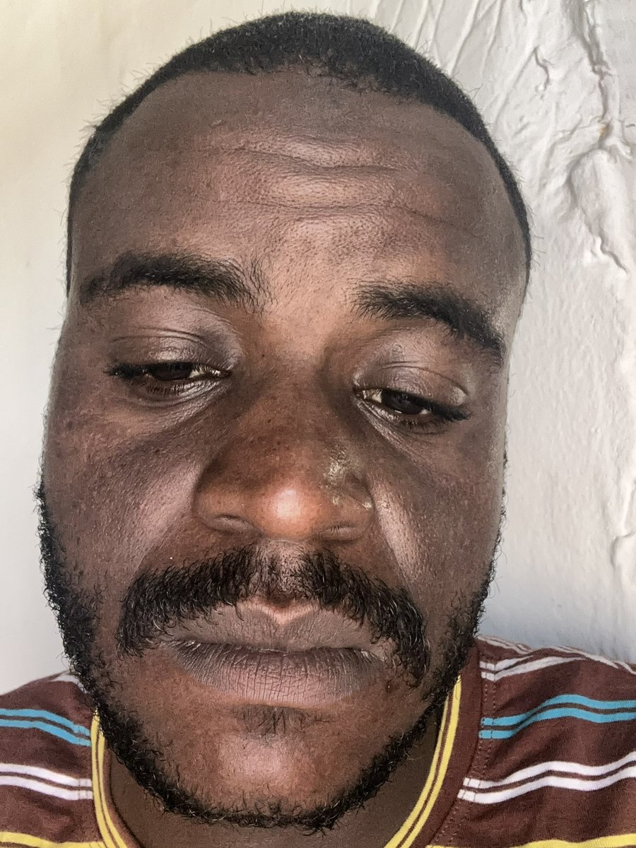 I'm trying to survive, but survival is not possible in silence.

If you see this, don't miss Me , and just leave a dot to show that you saw me.

gofund.me/52f7f9d6