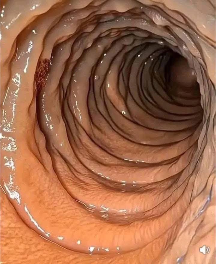 Which machine is used to drill this hole