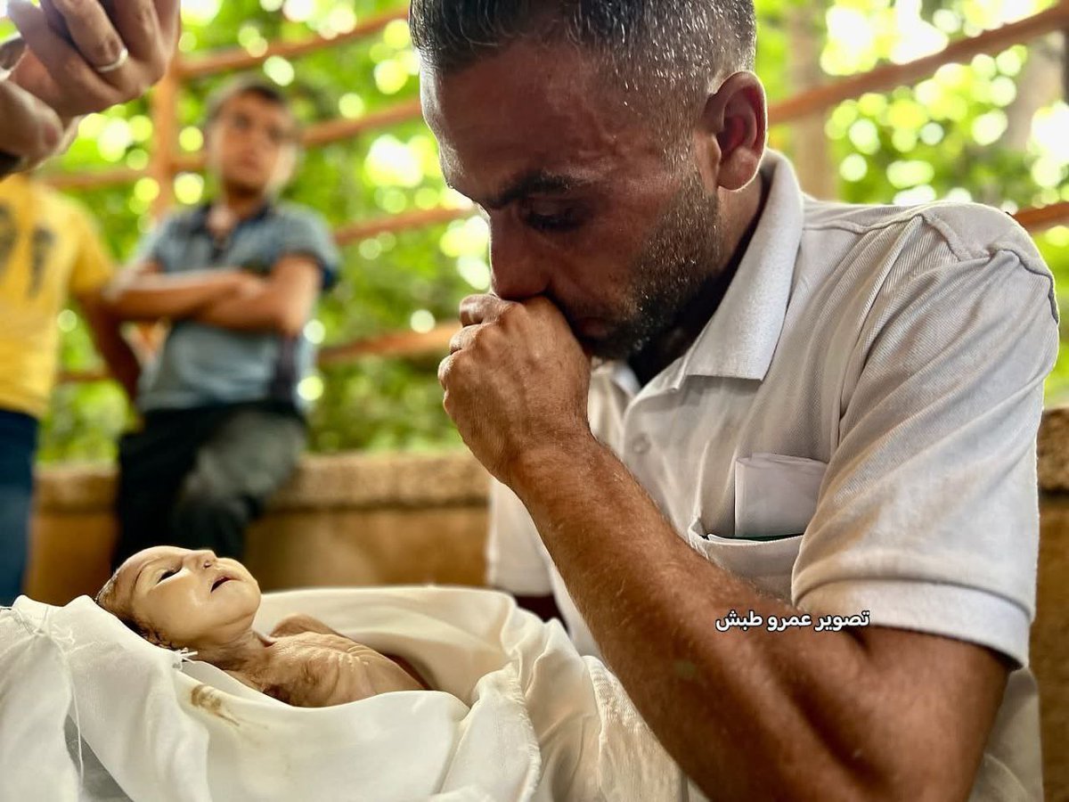 5-month-old Ghadeer Breika died this morning due to malnutrition and the lack of medical treatment.

Zionists and their apologists are worse than Nazis, far worse.

#GazaStarving 
#GazaHolocaust