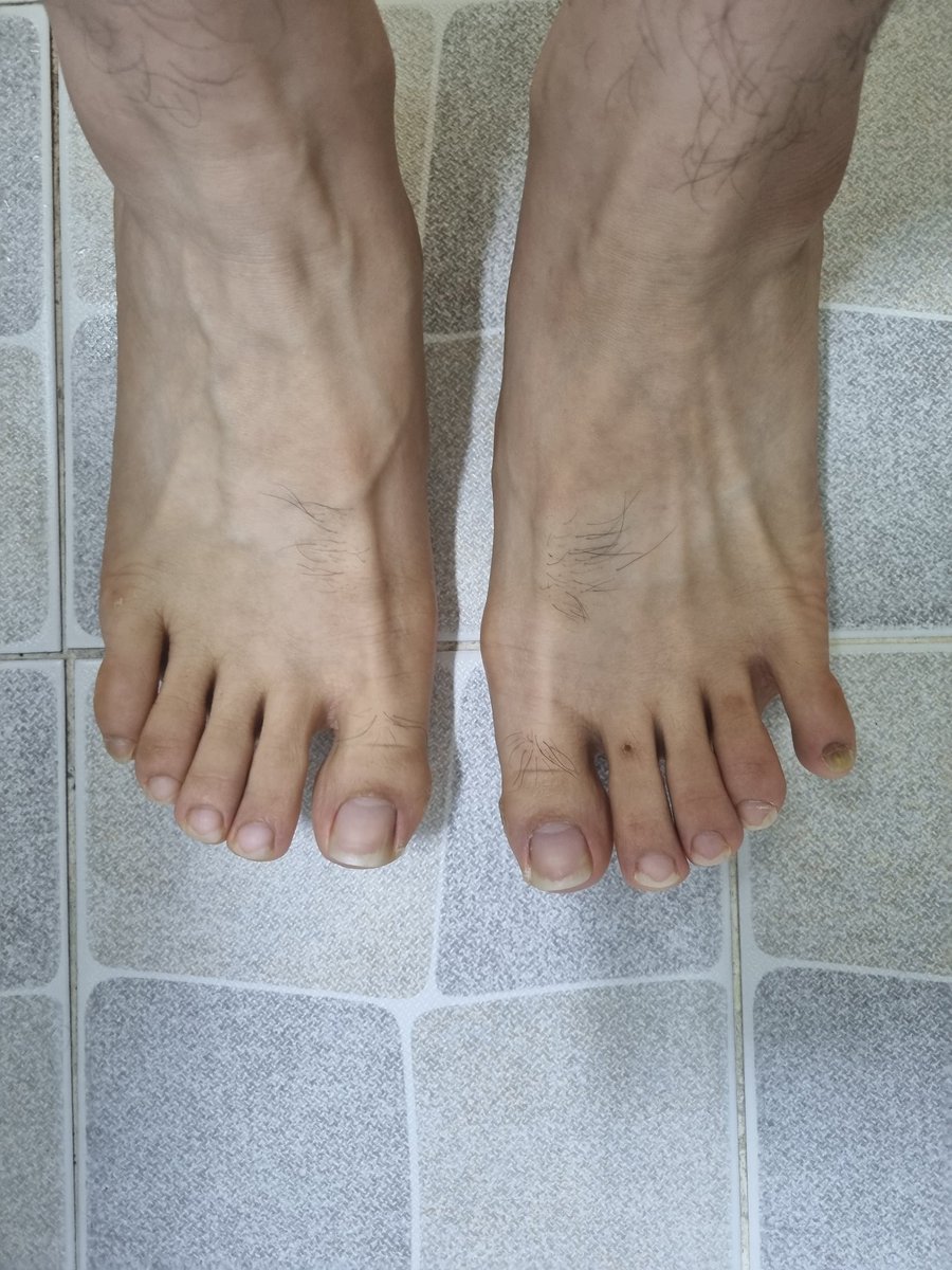 y23bs's tweet photo. #남자발 #malefeet #맨발 #barefoot https://t.co/FkxZJUt5nP