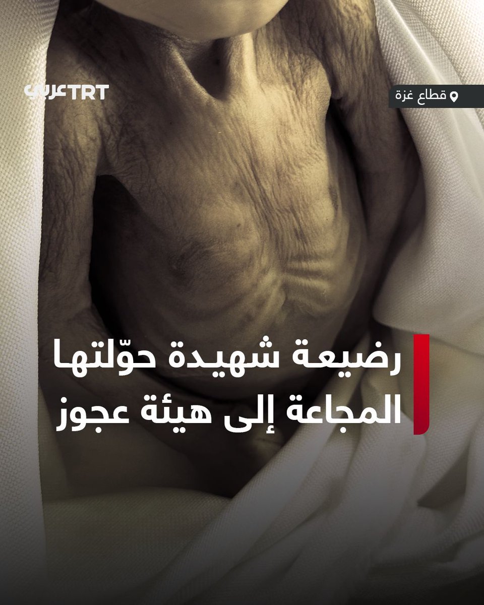 TRT عربي tweet media