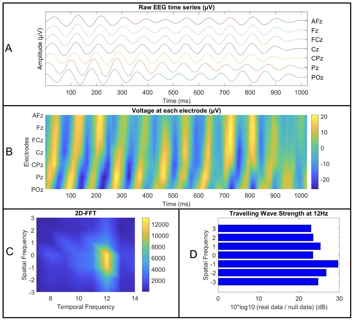 New paper in Imaging Neuroscience by Neil W. Bailey, Luiza Bonfim Pacheco and Luke D. Smillie:

Cortical travelling waves relate to variation in personality traits

doi.org/10.1162/IMAG.a…