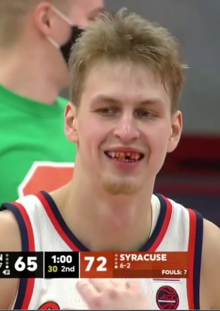 #NationalToothFairyDay 🍊