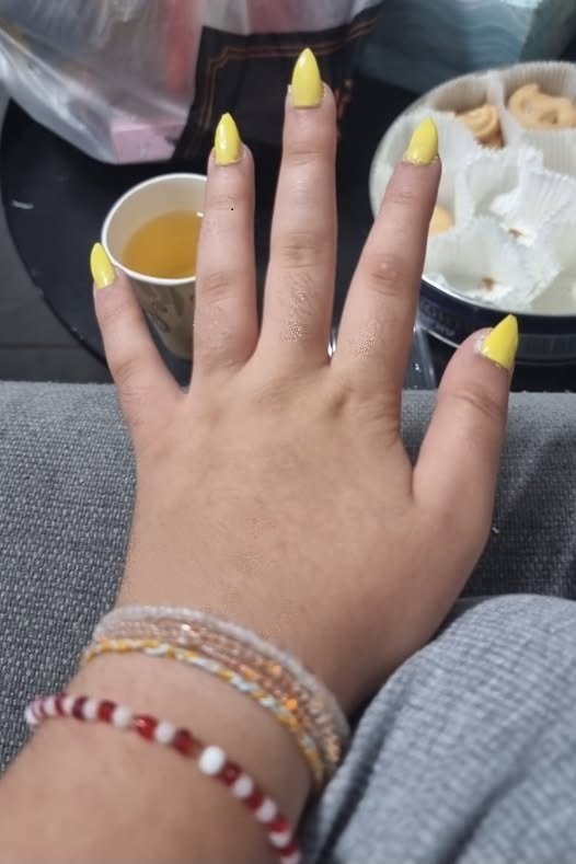 ליה, הבת שלי עם הצרכים המיוחדים, צובעת את הציפורניים בצהוב.

כל מה שמעסיק אותה זה מתי החטופים יחזרו.

היא חושבת צהוב כל היום. 💛