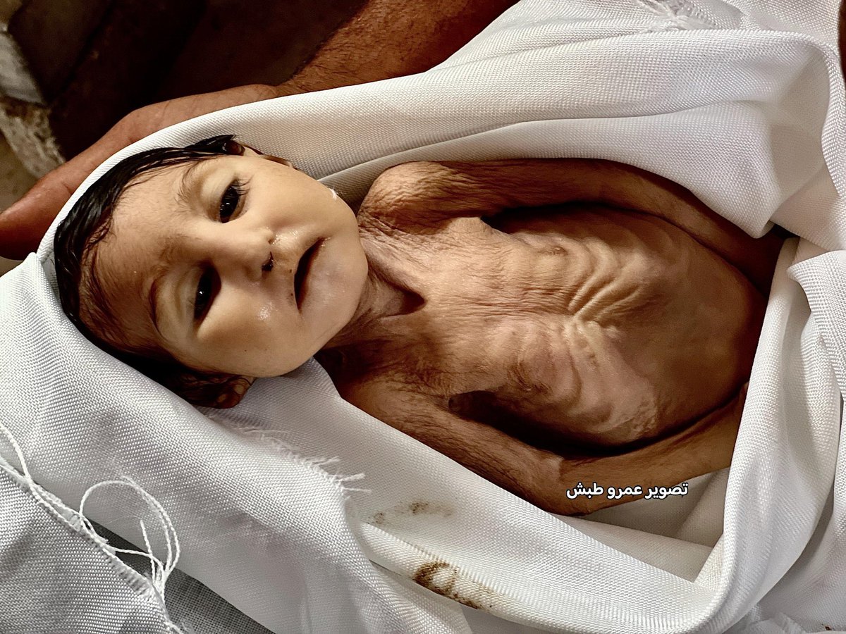 Açlıktan hayatını kaybeden 5 aylık bebek..

- Gazze 2025