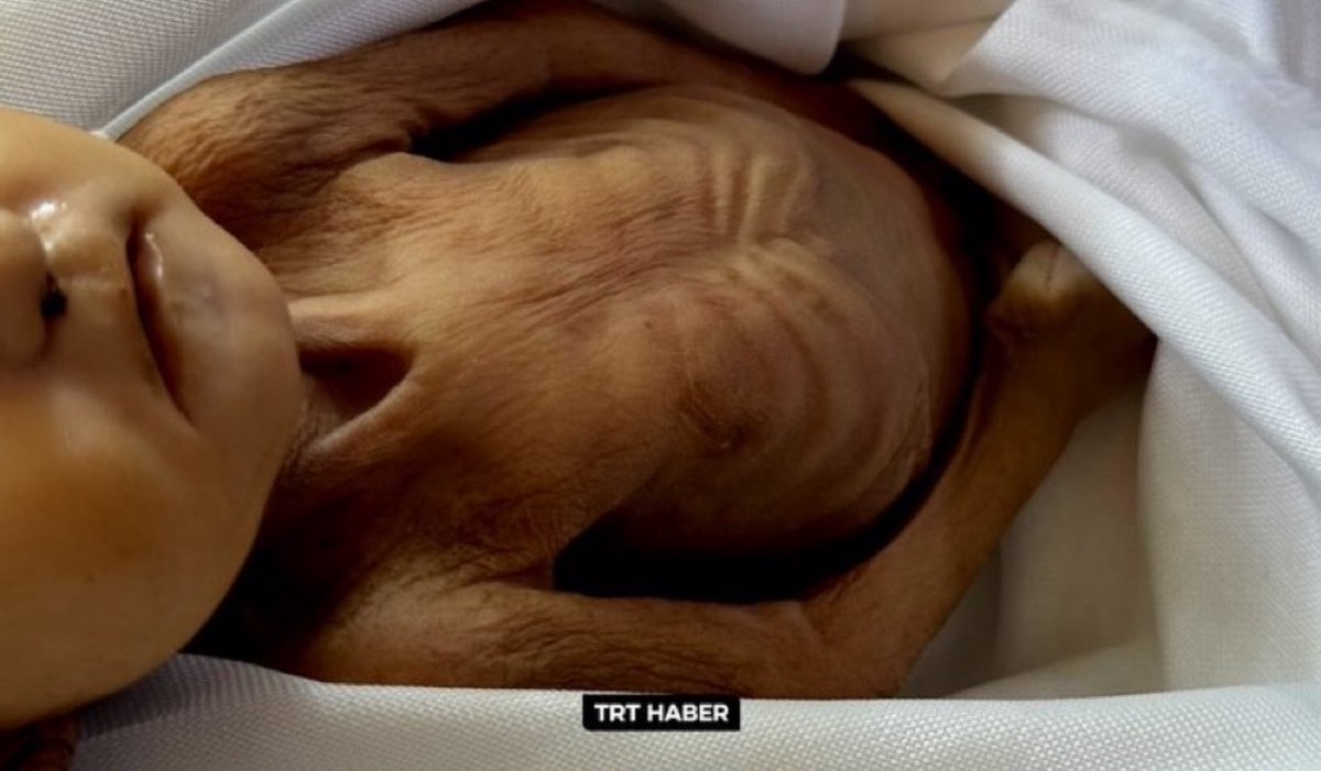 5 aylıktı ama sanki 50 yıllık zulüm yaşadı..