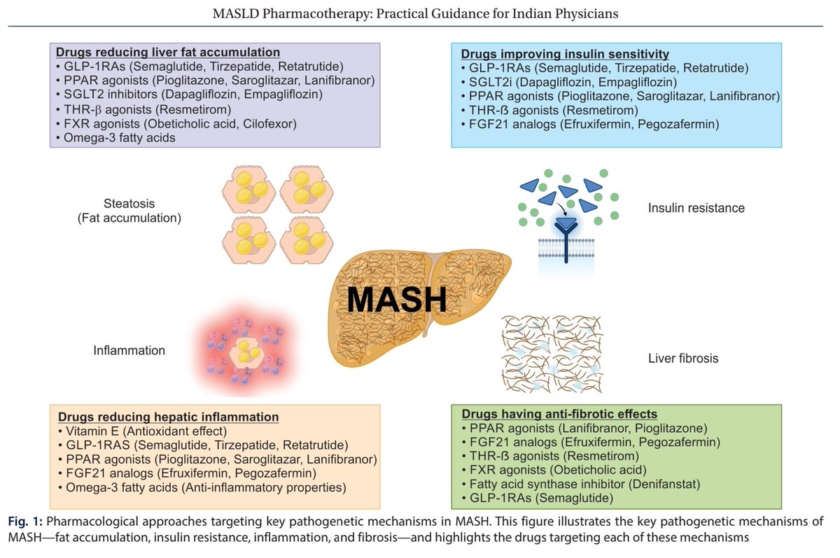 CMEINDIA1's tweet photo. MASLD Pharmacotherapy – Clinical Pearls for Indian Physicians
@DrAshish_Kumar
Very illuminating article in JAPI , July 2025
1. Lifestyle: The Foundation

Hypocaloric, balanced diet:
• 50% carbs, 30% fat, 20% protein.
• Prefer whole grains, legumes, nuts, vegetables, fruits, lean proteins.
• Avoid sugar-sweetened drinks, refined carbs, processed foods, excess saturated fats.

Coffee (2–3 cups/day) → ↓ fibrosis risk, ↓ HCC risk.

Omega-3 rich fish (salmon, mackerel, sardines) → anti-inflammatory benefit.

Physical activity:
• 150–300 min/week moderate activity (walking, cycling, swimming).
• Encourage NEPA (stairs, chores, 8–10k steps/day).

Weight loss:
• ≥10% → 90% MASH resolution, up to 45% fibrosis regression.
• Even 5–7% ↓ weight → improves steatosis and liver enzymes.

2. Algorithm Tailored for India

Designed for noncirrhotic MASLD (F0–F3), to be applied by general physicians and diabetologists.

Cirrhosis (F4) → Refer to hepatologist (portal HTN, HCC surveillance, transplant consideration).

Bridges gap between evidence-based guidance and Indian real-world primary care.

3. Pharmacotherapy: Adjunct to Lifestyle

Insulin:
• No proven benefit on fibrosis or MASH.
• Use for glycemic needs but not for liver histology. Prefer drugs with dual benefit.

Nondiabetic MASLD (F0–F1, LSM <8 kPa):
• Pharmacotherapy not strongly recommended.
• Consider only if lifestyle fails:
– Vitamin E:
▸ PIVENS trial: 800 IU/day → improved steatohepatitis in nondiabetics.
▸ Concerns: prostate CA risk, long-term safety.
▸ Lower dose 300 mg/day × 96 wks → improved steatosis, inflammation, fibrosis with better safety.
– Omega-3 fatty acids: modest ↓ steatosis; inconsistent fibrosis benefit → weak recommendation.

4. India-Specific Practical Points

Unlike West (hepatologist-driven), in India MASLD is mainly managed by GPs & diabetologists.

No widely adopted simple pharmacological algorithm yet → this guidance fills the gap.

Pharmacotherapy decisions should be guided by fibrosis stage + diabetes status.

✅ Key CME Takeaway:
In India, lifestyle modification remains first-line for all MASLD patients.

Drugs are adjuncts, reserved for higher-risk or progressive disease.

Vitamin E (low-dose) and omega-3 may help in select nondiabetic, low-fibrosis cases.

Insulin should be used cautiously, prioritizing agents that improve both glycemic and hepatic outcomes.

Structured, India-specific algorithms can empower general physicians and diabetologists to manage MASLD effectively, reserving hepatology referral for cirrhosis (F4).
https://t.co/e84mSvGjGz