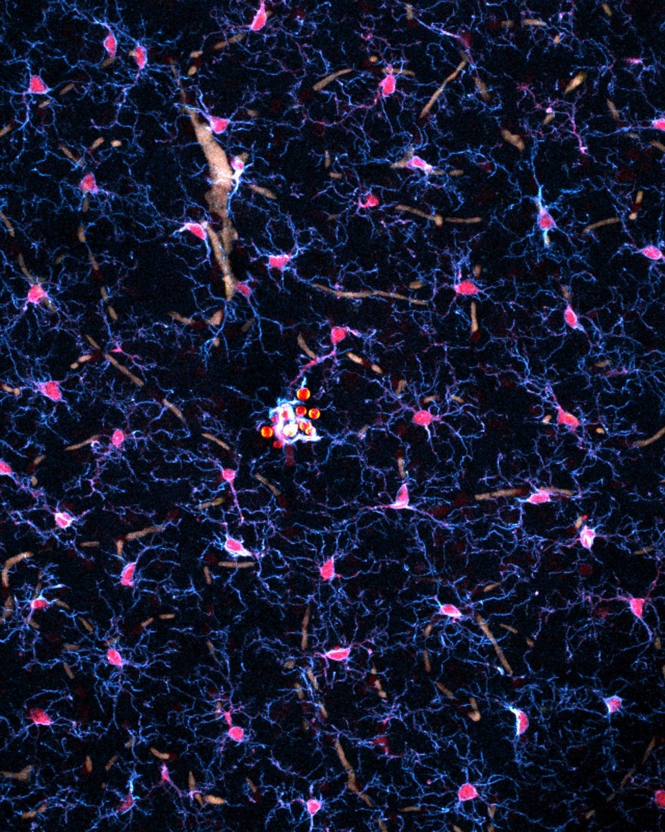MRCcmm's tweet image. 🔬 #imageoftheweek ¦ A rare glimpse of Cryptococcus neoformans (orange) in the brain, surrounded by immune cells called microglia (blue/pink). Scientists scanned large tissue areas to find these clusters, part of a global effort to understand this deadly fungus. 

#microscopy