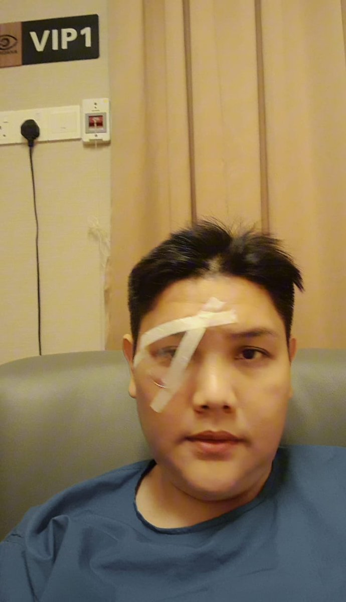 Punya la handsome,  mata kanan dah repair,  mata kiri belum... alhamdulillah