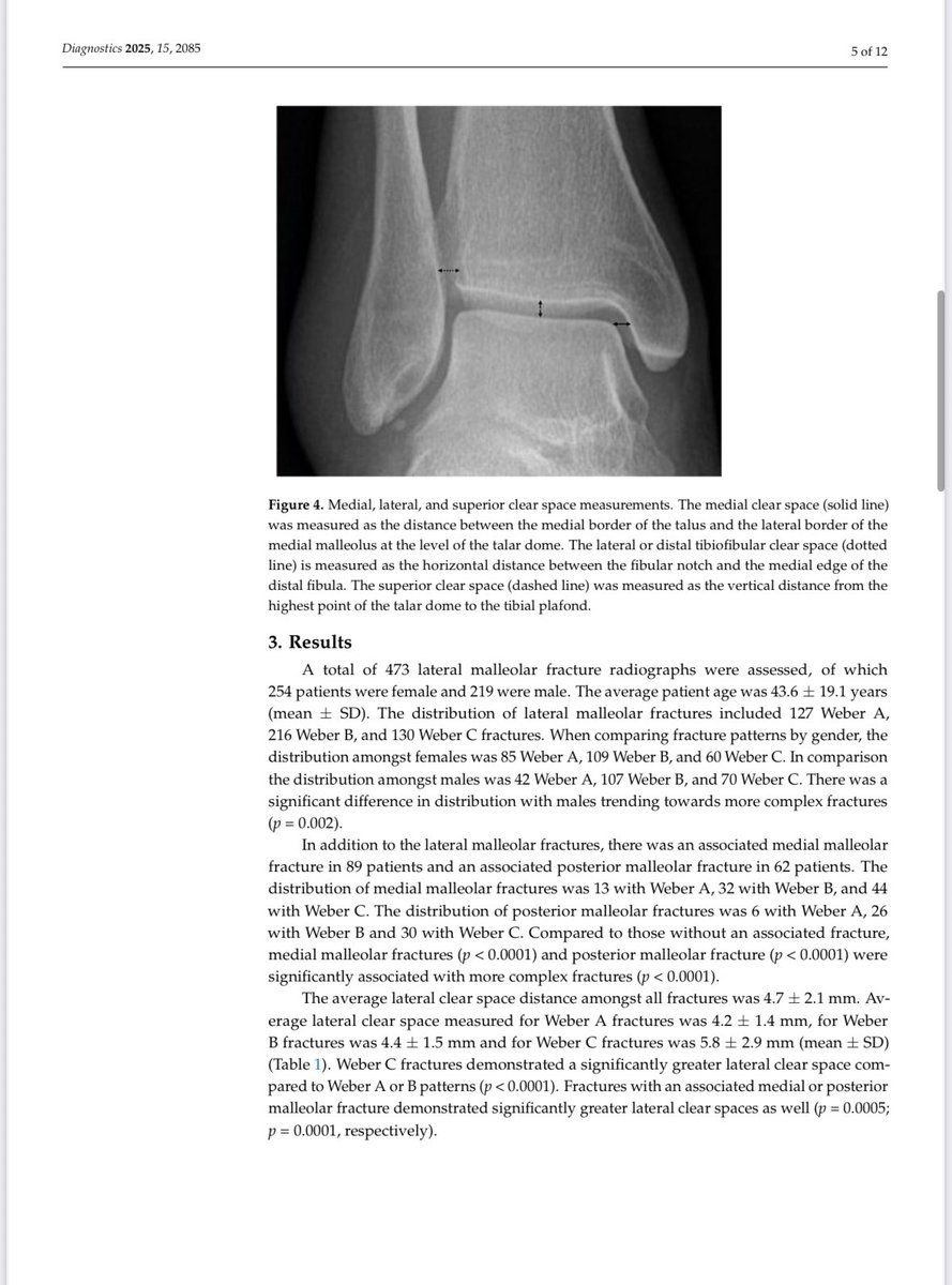 Are deltoid ligament injuries tied to Weber #ankle fractures? New study incl Drs Surmanowicz, Hamilton, Sahota &amp; Obaid (473 cases) shows medial clear space widening (w implied deltoid injury) rises from A → B → C, with Weber C highest risk. #Xray #radiology