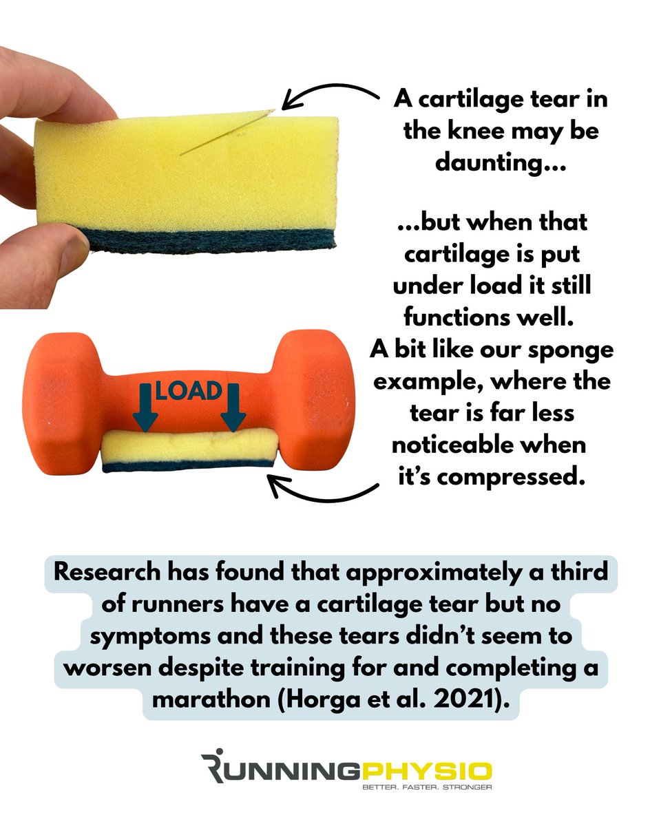 It can be hard to reassure a patient who has been told they have a cartilage tear in the knee. I’ve tried to create a visual example of how the cartilage can still work well under load. Does it work? 🤔

This is a work in progress, I welcome your feedback (even if it’s to say