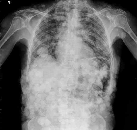 Dr Ihab Suliman tweet media