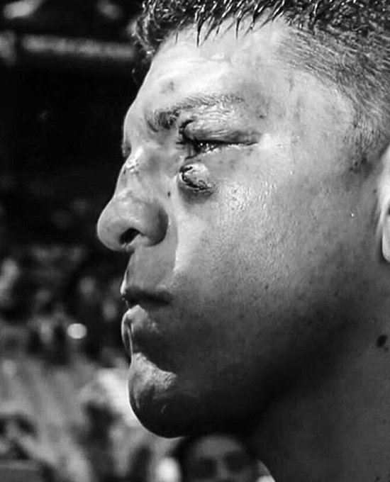 It wasn’t so easy, especially starting out, I fought all hard guys and I didn’t have ten people coaching, training, and feeding me.—Nick Diaz