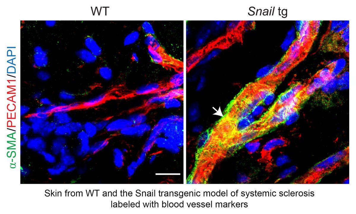 Journal of Clinical Investigation tweet media
