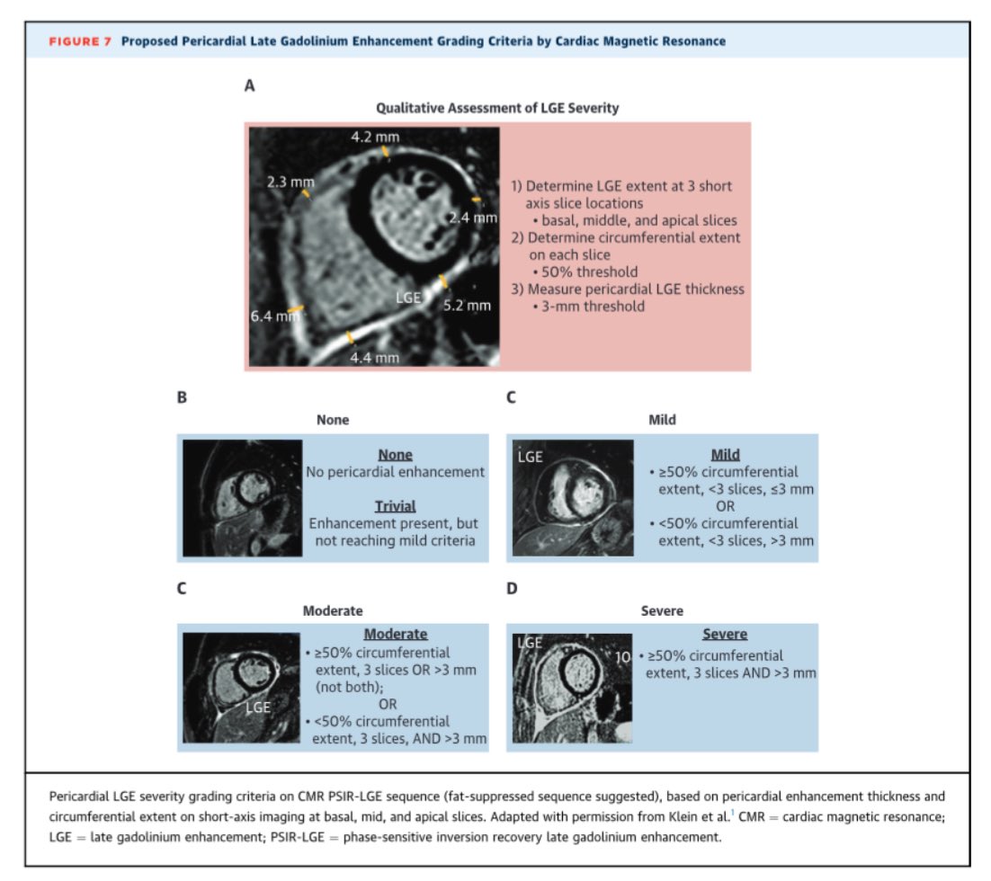 🔴 2025 Concise Clinical Guidance: An ACC Expert Consensus Statement on the Diagnosis &amp; Management of Pericarditis: A Report <a href="/JACCJournals/">JACC Journals</a> <a href="/ACCinTouch/">American College of Cardiology</a> <a href="/AHA_Vida/">Vida Saludable</a> <a href="/American_Heart/">American Heart Association</a> #Cardiology #CardioEd #pericarditis #FOAMed <a href="/sneha_vk/">Sneha Vakamudi MD, MSc, FACC</a> <a href="/MMukherjeeMD/">Monica Mukherjee MD, MPH</a>