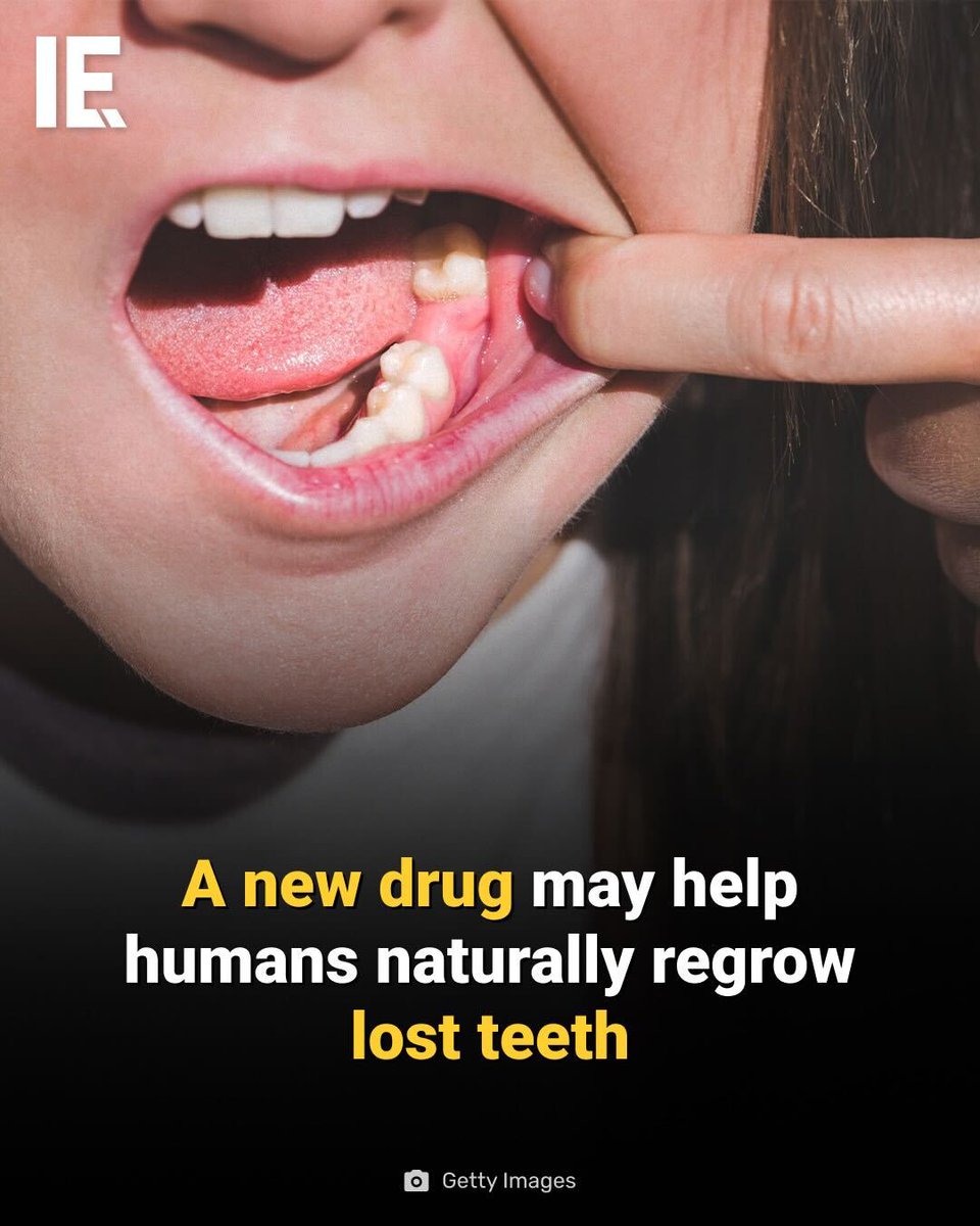 In October 2024, Japanese scientists began human trials of TRG-035, a drug designed to regenerate teeth by inhibiting the USAG-1 protein. Early animal studies demonstrated successful tooth regrowth, and current trials at Kyoto University Hospital involve adults missing at least