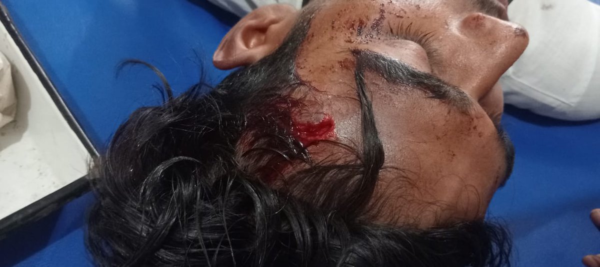 Nishuazad11's tweet photo. 🚨 आपात सूचना 🚨
आज शाम 7 बजे म���रे परिचित पूर्व जिला महामंत्री, आज़ाद समाज पार्टी - कांशीराम, अतुल कठेरिया के आवास ग्राम हुसैनपुर बांगर, थाना नवाबगंज, ज़िला फर्रुखाबाद पर भाजपा से जुड़े गुंडों द्वारा जानलेवा हमला किया गया।
हमले में उनके छोटे भाई को गंभीर चोटें आई हैं।

मैं @Uppolice @fatehgarhpolice @upgovt @dgpup से मांग करता हूँ कि:

आरोपियों की 48 घंटे में गिरफ्तारी हो

पीड़ित परिवार को तत्काल सुरक्षा दी जाए

दोषियों पर सख़्त से सख़्त कार्रवा�� हो

��गर 48 घंटे में कार्रवाई नहीं हुई तो भीम आर्मी और आजाद समाज पार्टी - कांशीराम महाआंदोलन के लिए बाध्य होगी और नवाबगंज कोतवाली का घेराव किया जाएगा।

📍 एफआईआर दर्ज — आरोपियों के नाम पुलिस को दे दिए गए हैं।
⚠ जिम्मेदार: उत्तर प्रदेश पुलिस व वर्तमान भाजपा सरकार।

#JusticeForAtulKatheria #BhimArmy #AzadSamajParty #UPPolice #FatehgarhPolice #UPDGP #UPGovt