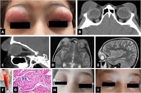What is your diagnosis?  Source: Cureus