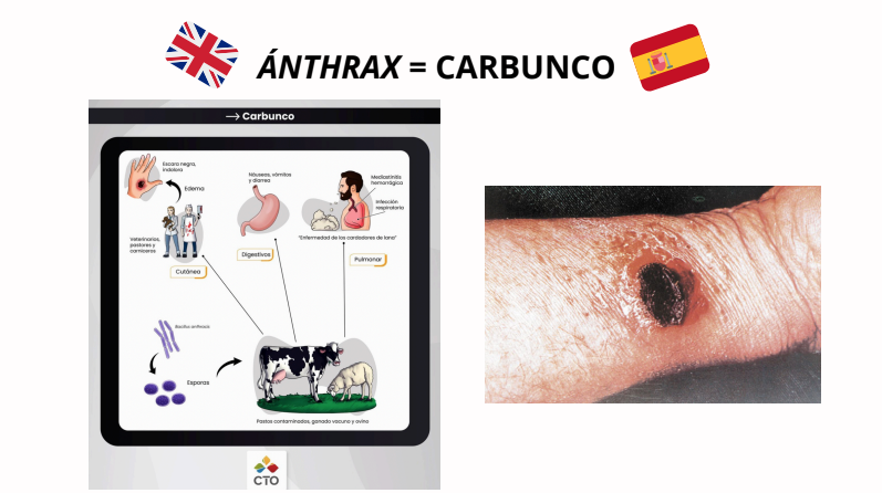 Un recorrido por las infecciones de piel más prevalentes en Atención Primaria. Para tener siempre a mano. #viernesdesesión 🤕🐍🏥🔬
drive.google.com/file/d/1zd_iCo…