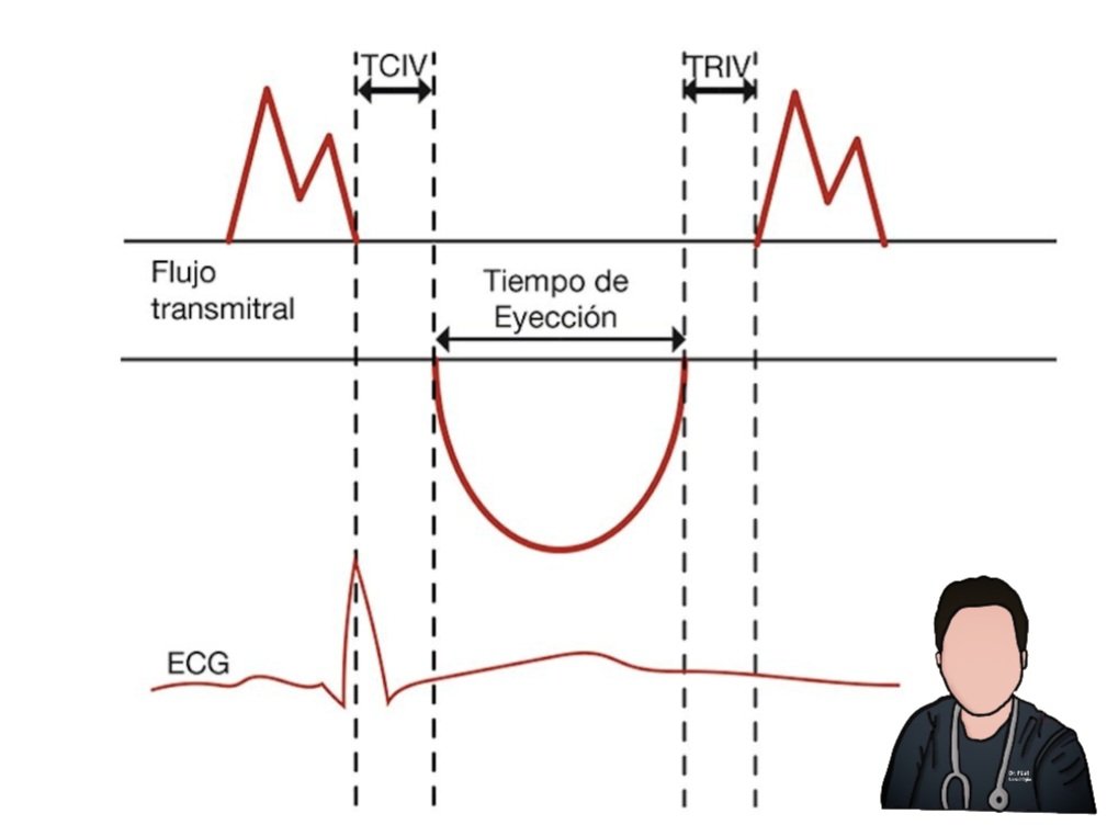 javier20ch's tweet photo. Índice de Rendimiento Miocárdico [índice de Tei]. 🛠🫀
⚙️En 1995, Chuwa Tei describió por primera vez el myocardial perfomance index (MPI), ahora conocido como índice de Tei. 👨‍⚕️🧾
⚙️El trabajo fue hecho en 69 pacientes con diversas cardiopatías y 45 controles, usando Doppler para medir tiempos de contracción y relajación isovolumétrica y tiempo de eyección. Así se estableció la fórmula y se demostró su independencia de la FC, TA y geometría ventricular. 💯👌🏻
⚙️Evalúa de forma global la función sistólica y diastólica del VI. 👇🏻🔎
✔️Formula: Tei = TCIV - TRIV / TE.
✔️Cortes: ≤0.39 normal, 0.40 - 0.59 disfunción leve, 0.60 - 0.79 disfunción moderada y ≥0.80 disfunción grave.

📚Tei C, et al. Am J Cardiol. 1995;75(14):1183–1186