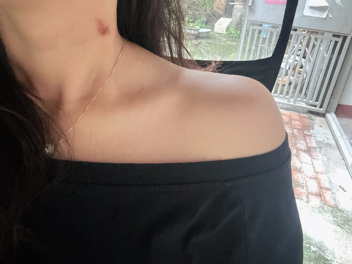 怎么都喜欢抱着我脖子使劲啃呢？