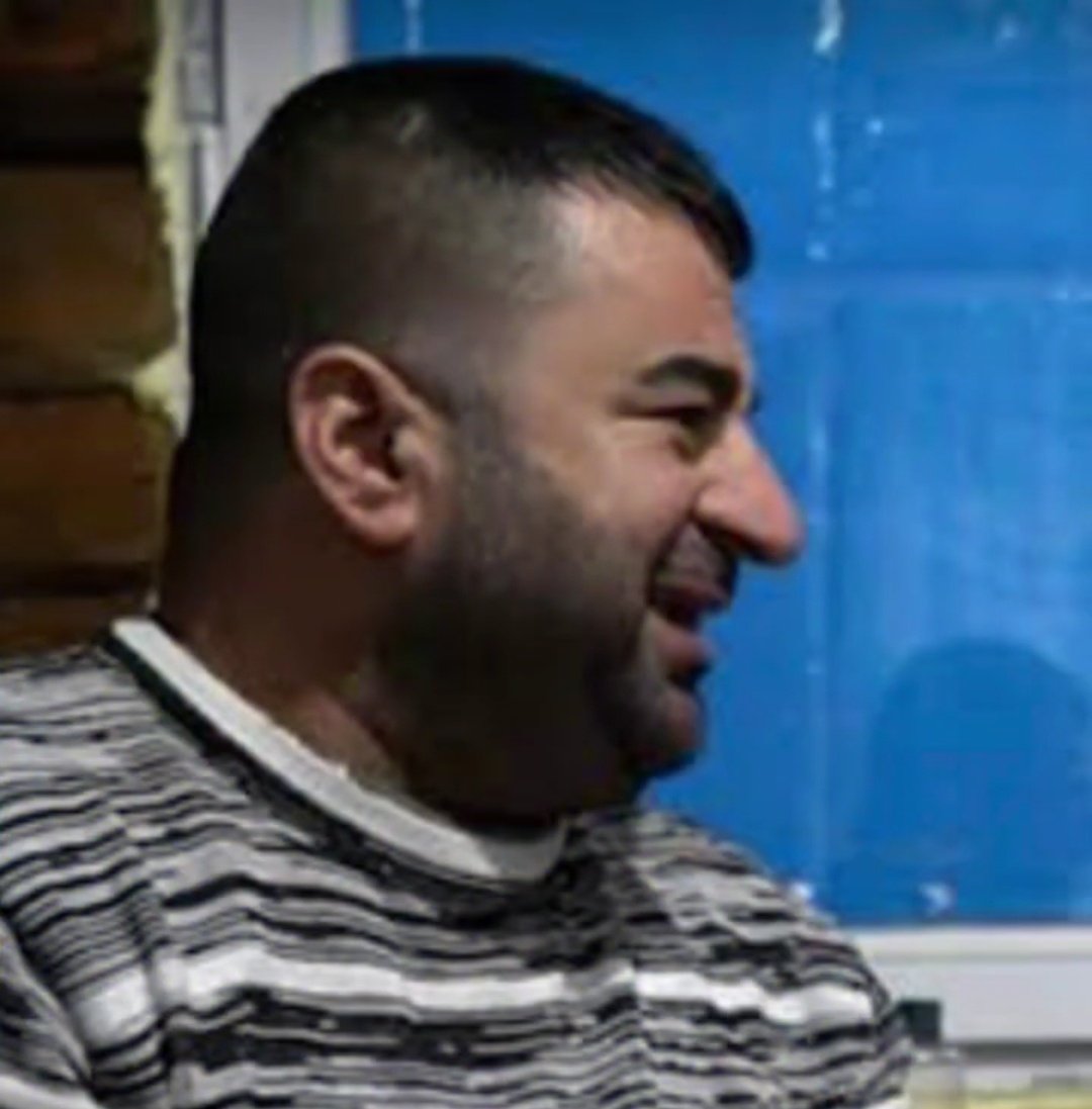 burun estetigi olmamıs kriterinde biz