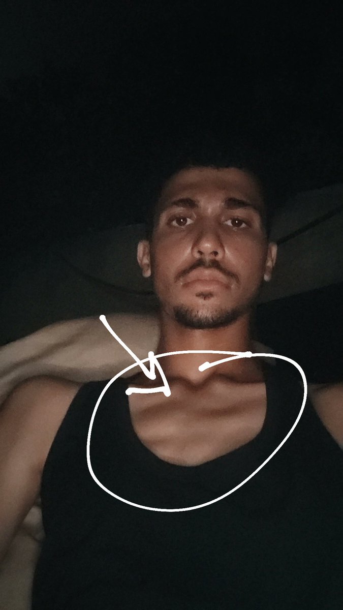 Osama_Gazaa's tweet photo. Look, my body is starting to get thin and my bones are showing 💔😞. https://t.co/H9Ah8vEBOe