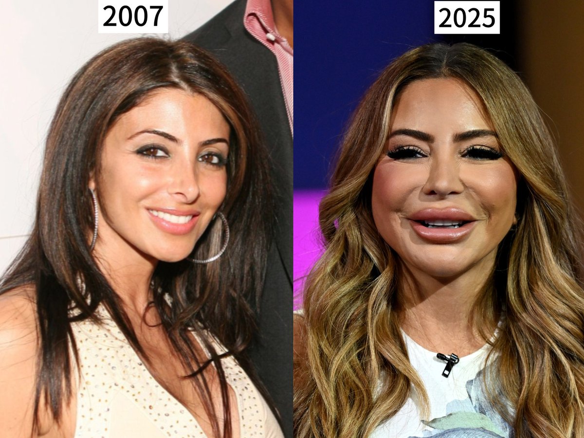 candybarr2009's tweet photo. Larsa Pippen says she has never had any plastic surgery on her face. She is Kim Kardashian’s best friend and the ex-wife of former basketball superstar Scottie Pippen. https://t.co/zmckYAG5f0