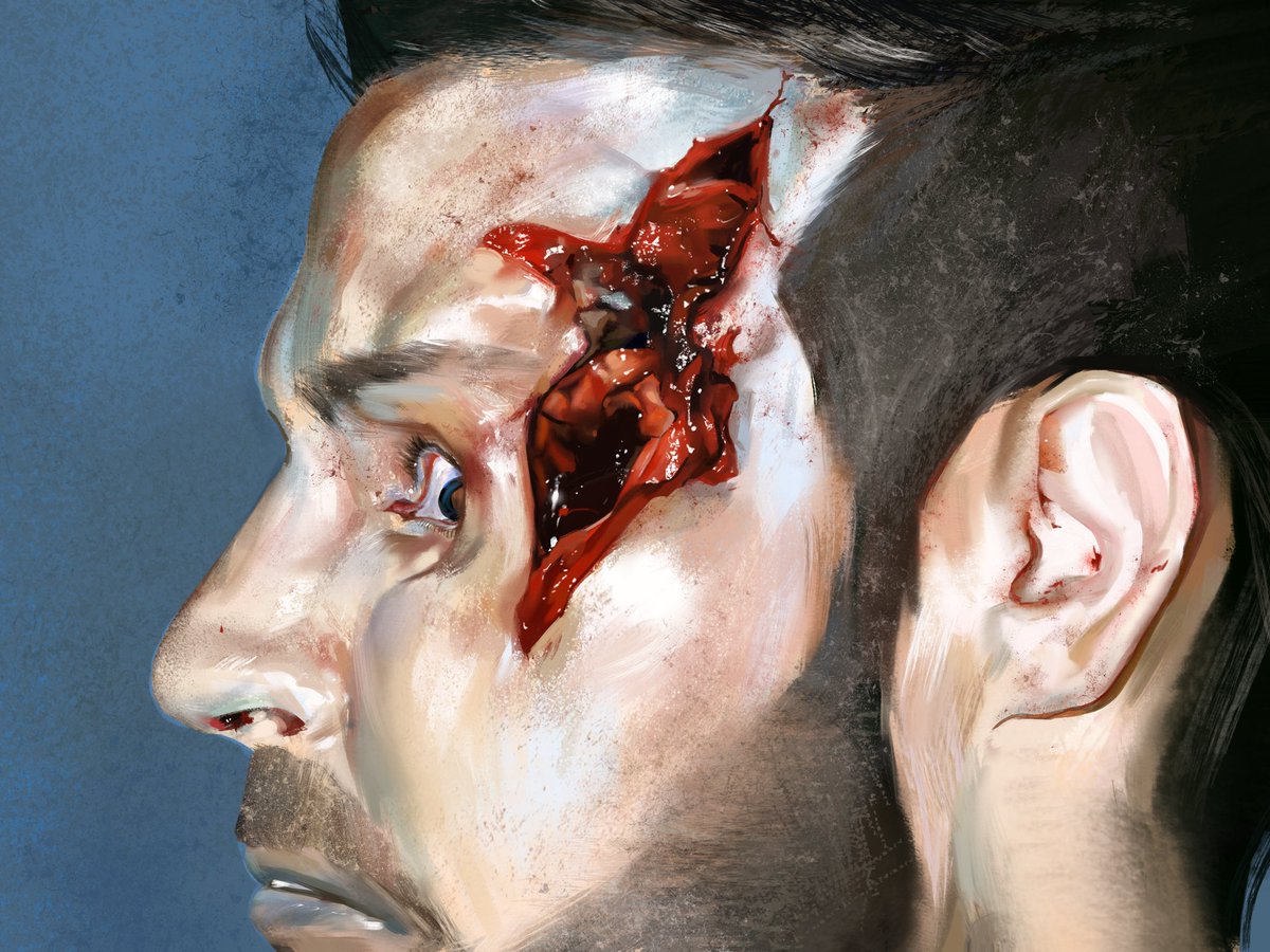 Johnny side eye. TW: MCD, GRAPHIC