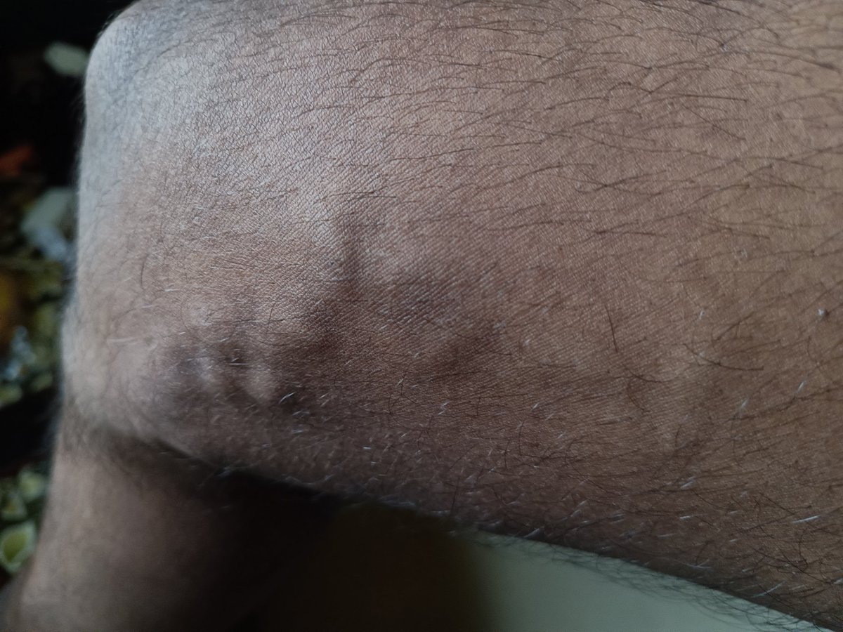 Dattatray84 tweet media