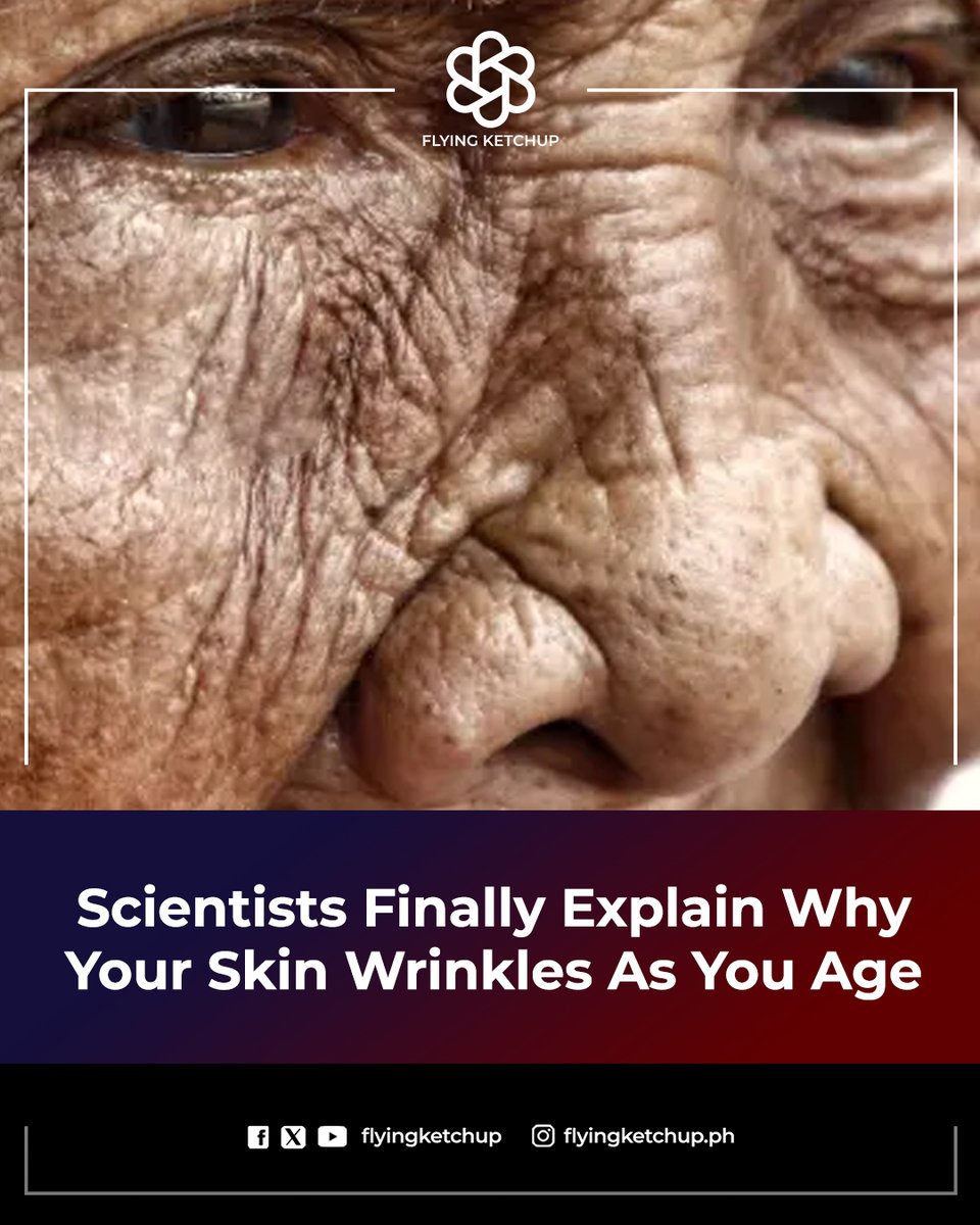 "As you get older, that contraction gets bigger. And if your skin is contracted too much, it buckles. That's how wrinkles form."

FULL STORY: tinyurl.com/29ar7gcm

#FlyingKetchup