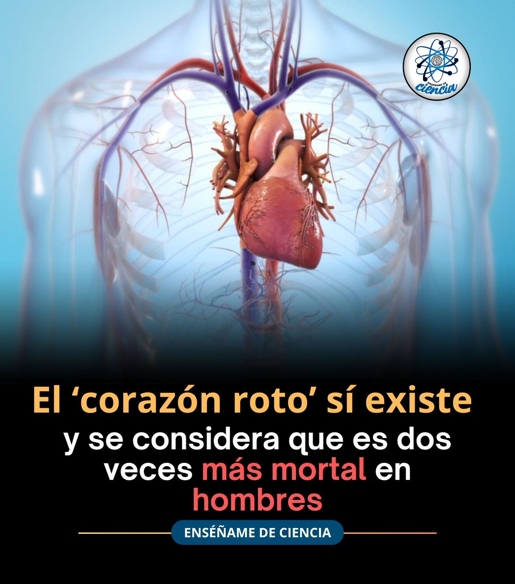 EnsedeCiencia's tweet photo. 🫀 Este síndrome resulta ser dos veces más mortal en hombres que en mujeres. https://t.co/4BT9g20MV3