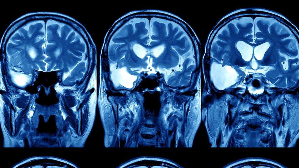 MarioNawfal's tweet image. 🚨 AN AI JUST LEARNED TO SPOT CANCER. NO CUTTING, NO WAITING.

Biopsy? For what? 

Chinese and Hong Kong researchers have developed OMMT-PredNet, an AI that can scan high-res photos of your mouth and predict - with near-clairvoyant accuracy - if a lesion is about to become…