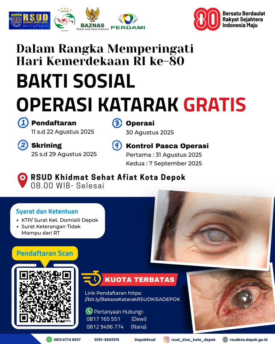 RSUD KiSA bersama Baznas Kota Depok dan PERDAMI Menggelar Bakti Sosial Operasi Katarak Gratis bagi warga Depok. Pendaftaran 11 s.d 22 Agustus 2025. Mau daftar? Scan langsung QR Code nya. Kuota terbatas
