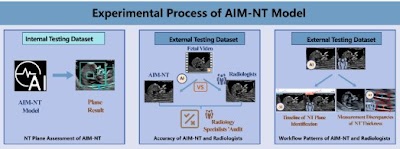 Radiology_AI's tweet photo. Artificial Intelligence Model for Real-Time Prenatal Nuchal Translucency Assessment: High Performance and Workflow Integration https://t.co/OIpwHD8axf @ShenzhenUni #ultrasound #RadUS #MachineLearning https://t.co/RQjC1xGvNK