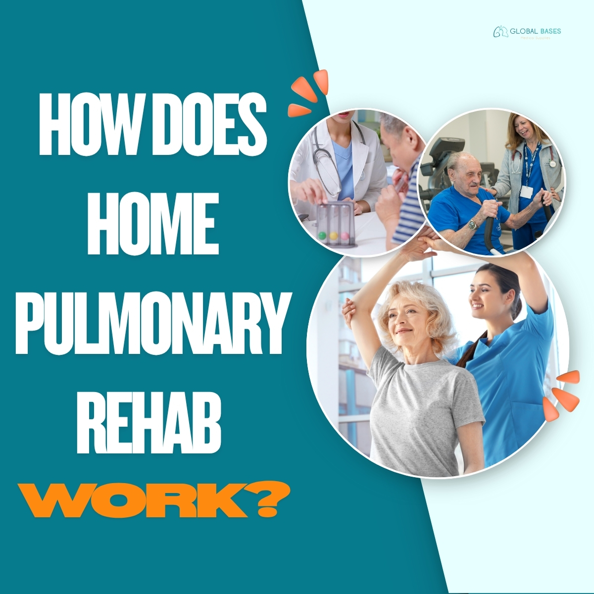 GlobalMed7's tweet photo. 🫁 Home Pulmonary Rehab – Here's How It Works!
You don’t need to visit a hospital to improve your lung function.
🏡 At home, patients receive:
Customized breathing exercises
Airway clearance techniques
Light physical activity guidance
Virtual or in-person check-ins with a respiratory therapist
Home rehab = real results.

🫁 التأهيل التنفسي في المنزل – كيف يعمل؟
لستَ بحاجة إلى الذهاب للمستشفى لتحسين صحة رئتيك.
🏡 في المنزل، يحصل المريض على:
تمارين تنفس مخصصة
تقنيات تنظيف مجرى الهواء
نشاط بدني خفيف
متابعة دورية مع أخصائي تنفسي
التأهيل المنزلي = نتائج حقيقية

#صحة_الرئة #التأهيل_المنزلي #الرعاية_التنفسية #COPD
#LungHealth #PulmonaryRehab #HomeRespiratoryCare #RehabAtHome