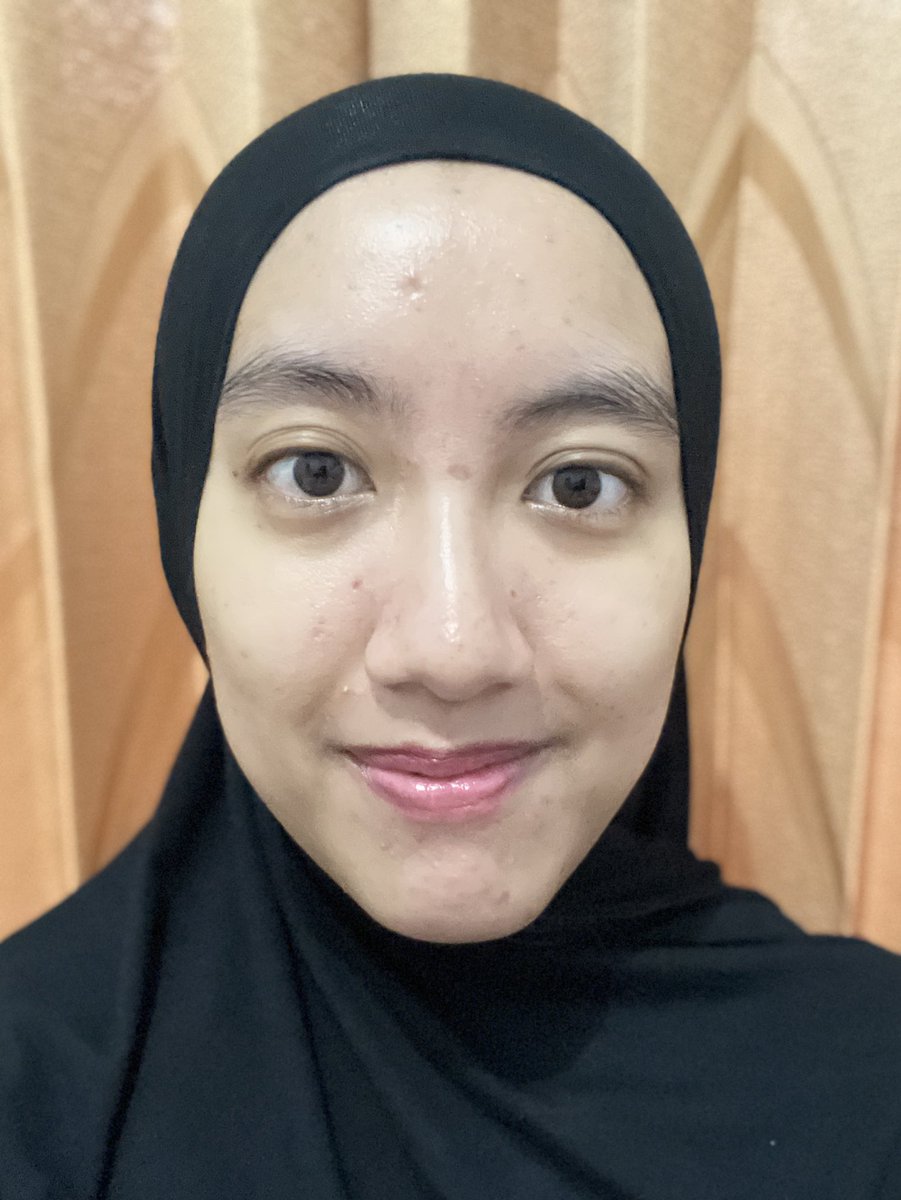 Korean Skincare : Is it a Hero or a Overhyped ??

For me, it is a HERO for my oily acne prone skin 🫵🏻